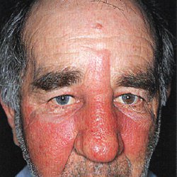 Сашок, Москва